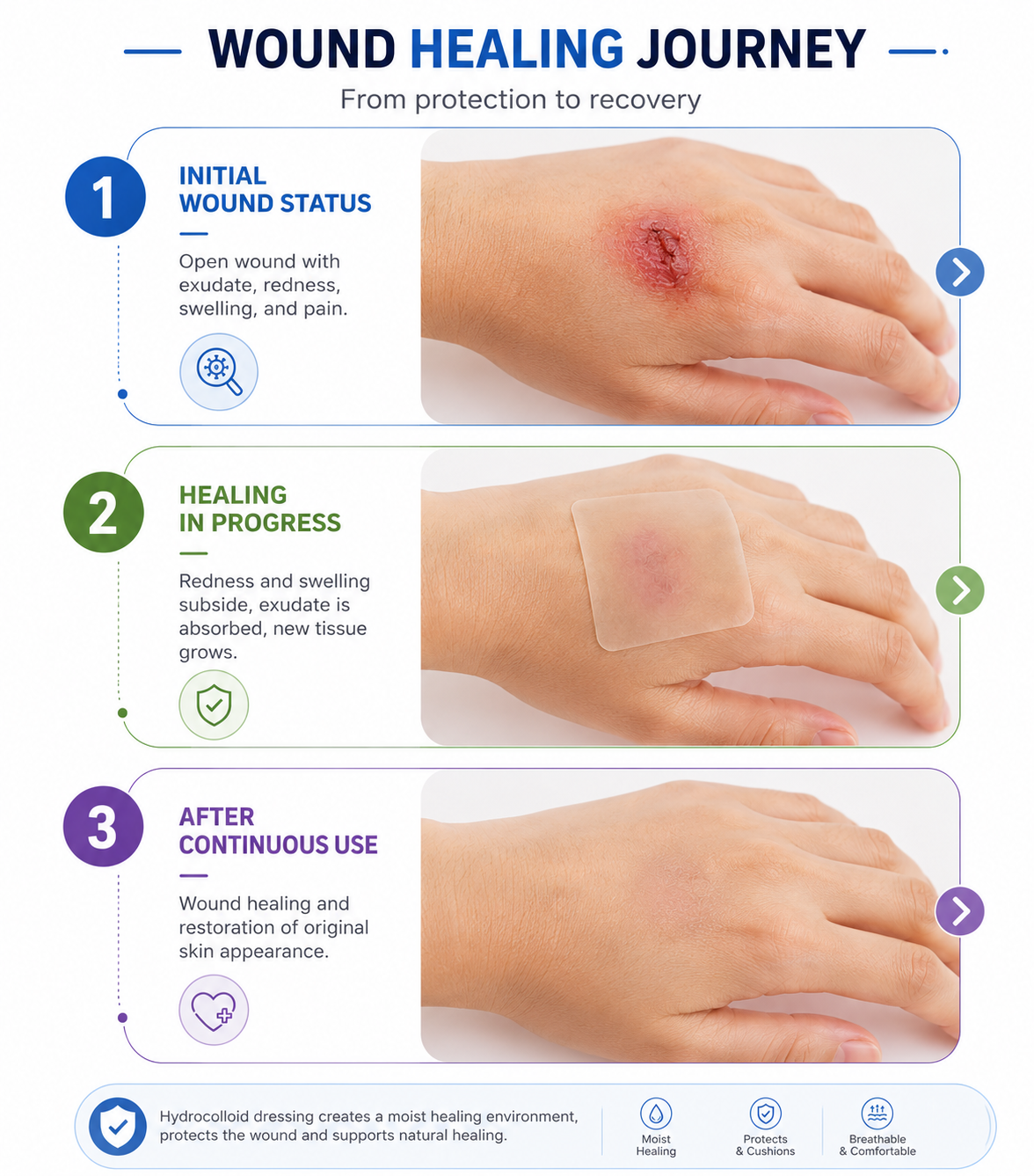 Medical-Grade Hydrocolloid Roll, Cut-to-Size